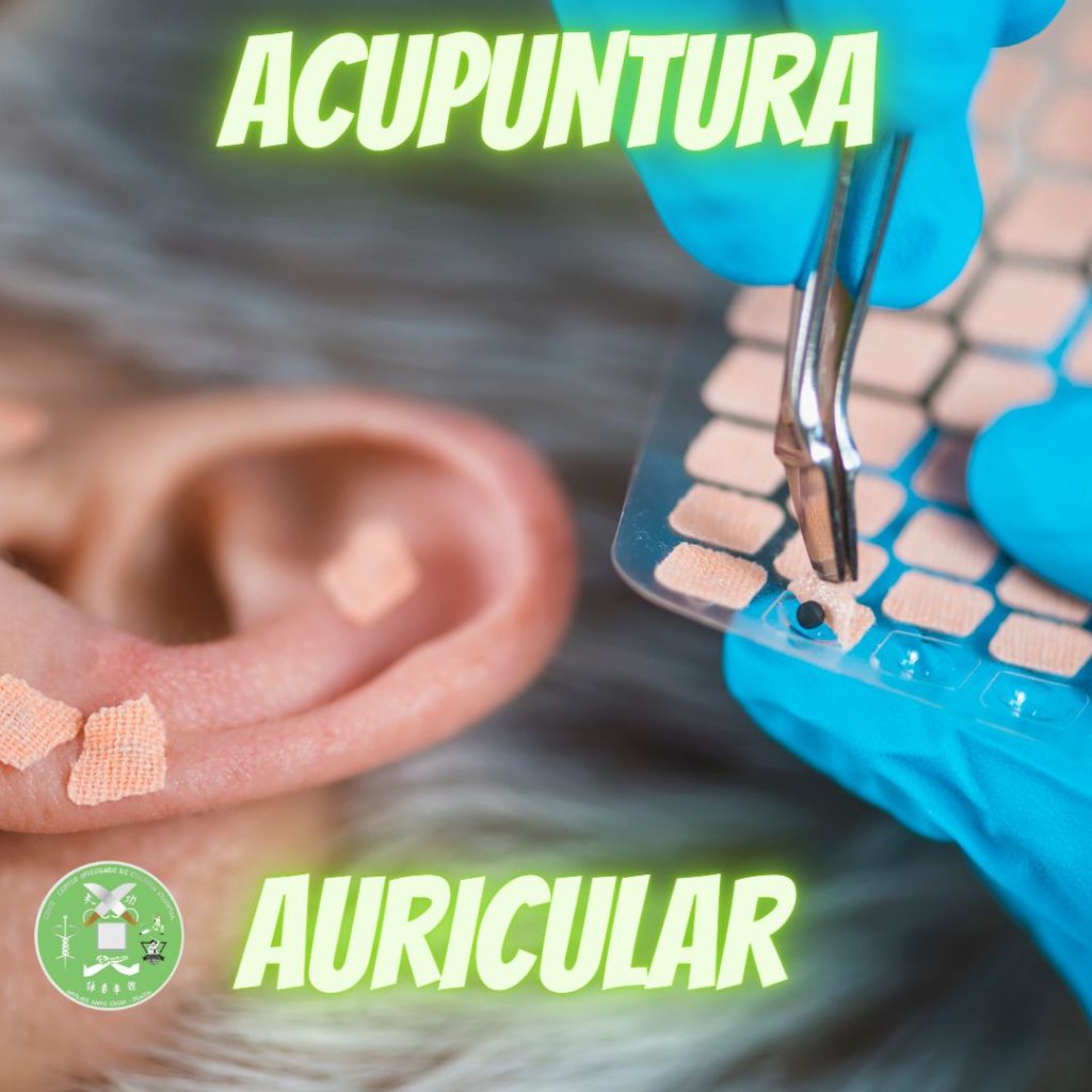 acupuntura auricular, auriculoterapia, terapia auricular