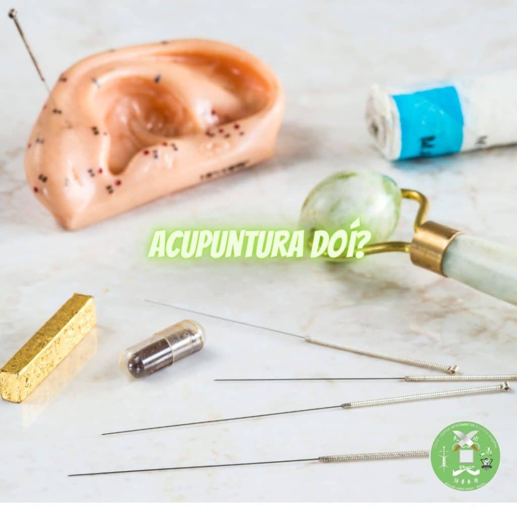 acupuntura doi