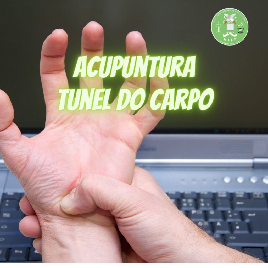 acupuntura tunel do carpo