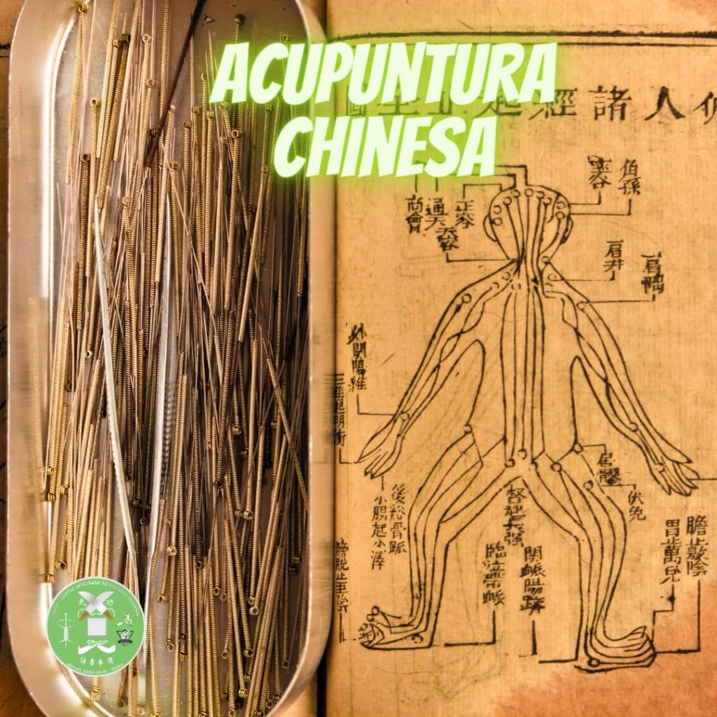 acupuntura chinesa