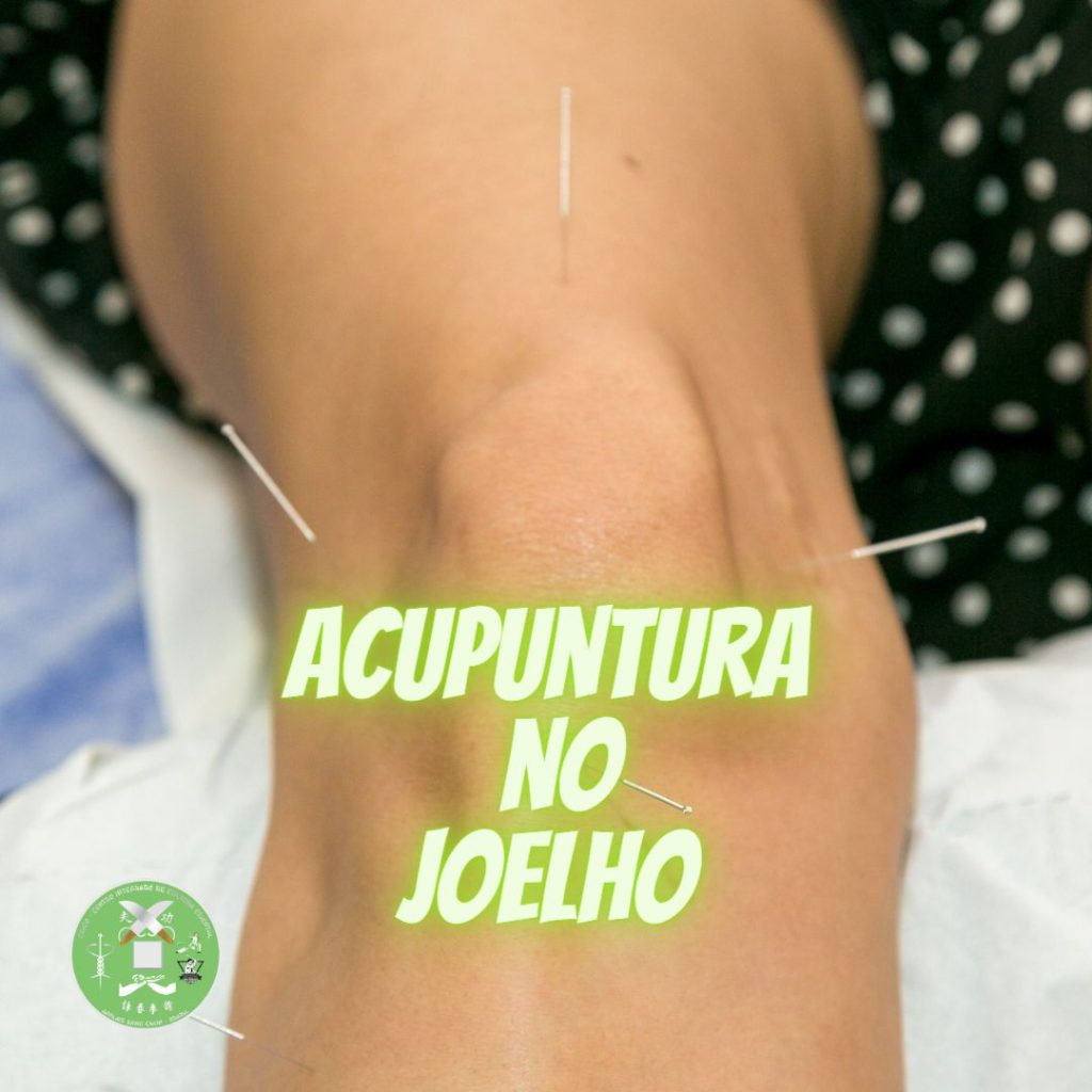 acupuntura no joelho