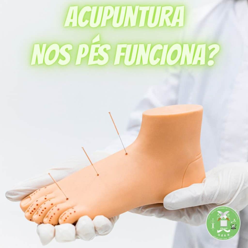 acupuntura nos pés