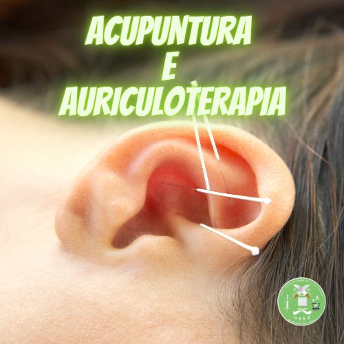 acupuntura e auriculoterapia