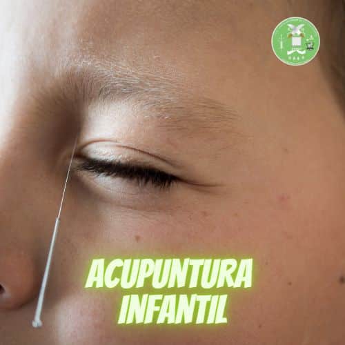 acupuntura infantil