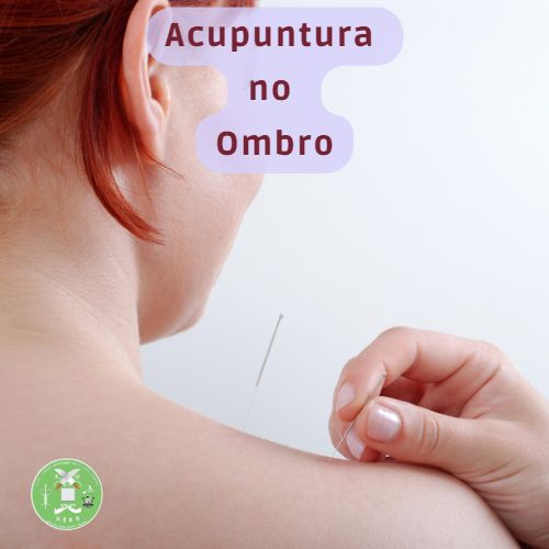 acupuntura ombro